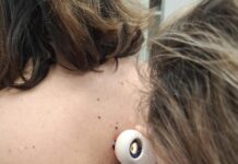 Ξέρεις πως να προστατεύεις το δέρμα σου;