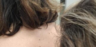 Ξέρεις πως να προστατεύεις το δέρμα σου;