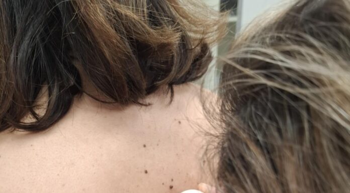 Ξέρεις πως να προστατεύεις το δέρμα σου;